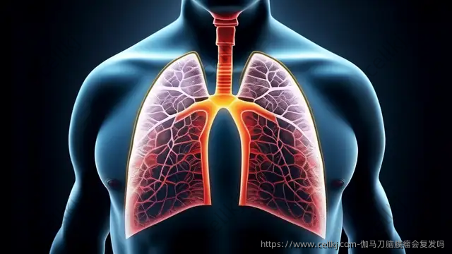 伽马刀脑膜瘤会复发吗